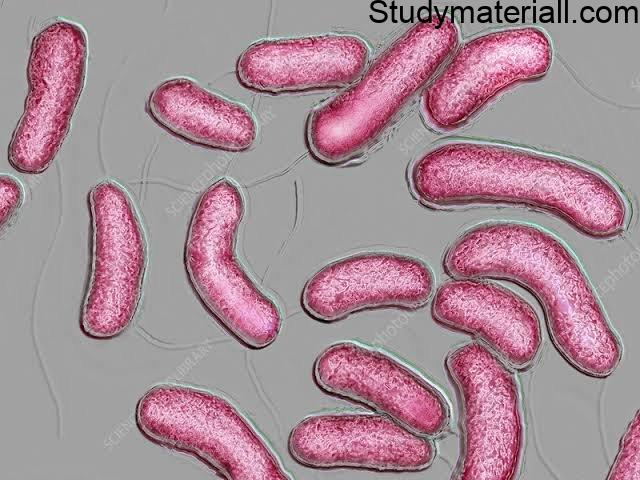 Cholera - Water Borne Disease, Symptoms of cholera, Management and Preventive Measures of cholera 3
