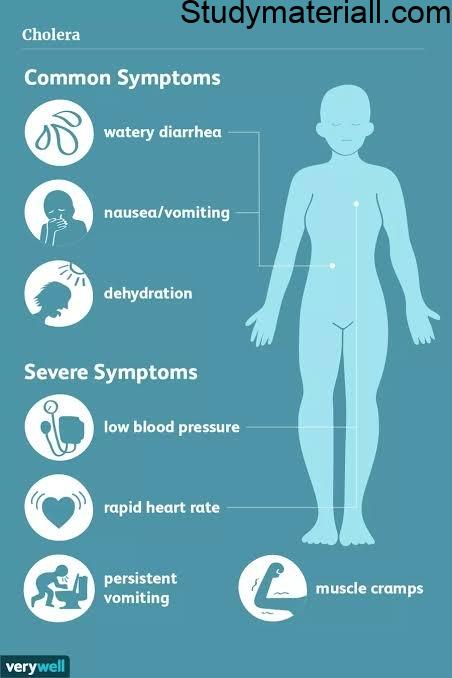 Cholera - Water Borne Disease, Symptoms of cholera, Management and Preventive Measures of cholera 4