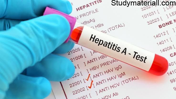 Hepatitis A, Liver infection, inflammation of liver, What is hepatitis virus,symptoms of liver infection, prevention from liver infection 2
