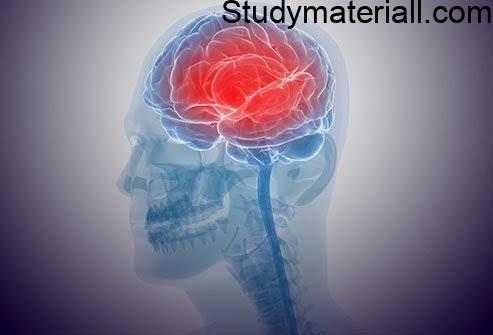 Encephalitis, brain inflammation or Swelling disease,Main cause of encephalitis, Symptoms of encephalitis, Symptoms of new born and infants 2