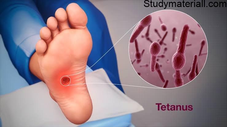 Tetanus Infection ,Damage Nervous system and Muscle, Symptoms of Tetanus infection 2