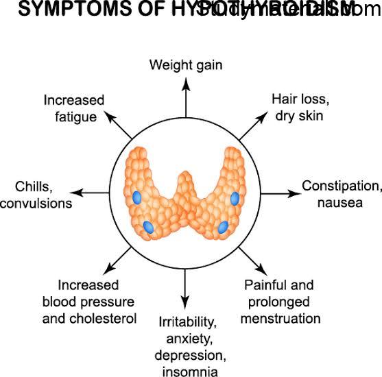 What is hypothyroidism, causes of hypothyroidism, sings and symptoms of hypothyroidism, treatment for thyroid 47