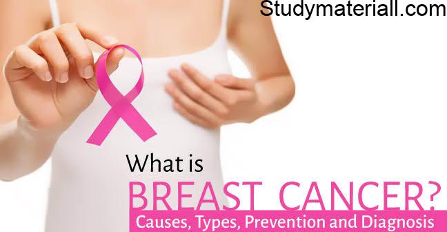 Breast Cancer, Causes of Breast Cancer, Signs and symptoms of Breast Cancer, Treatment for Breast Cancer 37